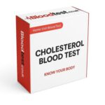 Cholesterol Blood Test Services Available in Warrington